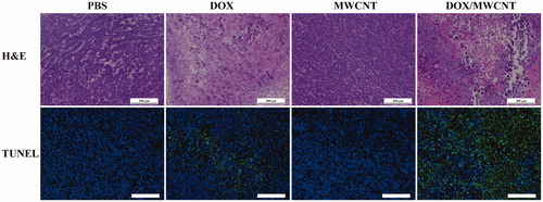 Figure 5. H&E staining and TUNEL staining of tumor sections after the tumor-bearing mice were treated differently according to grouping. The scale bar shown in each panel represents 100 μm.