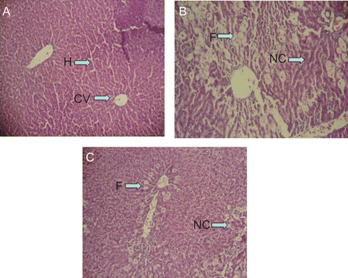 Figure 3.  Effect of partially purified protein against CCl4-induced histological liver injury: (A) normal control rats showing hepatic cells with well-preserved cytoplasm (H), well brought out central vein (CV) and prominent nucleus and nucleolus; (B) liver section of CCl4-treated rats showing massive fatty changes (F), necrosis (NC), and the loss of cellular boundaries; (C) liver section of rats treated with CCl4 and protein 100 mg/kg bw, retaining normal hepatic architecture with fewer areas of fatty change, and necrosis.