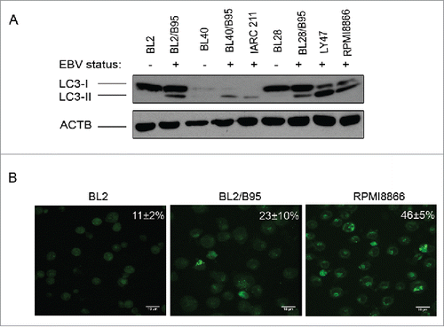 Figure 1. Analysis of constitutive autophagy in EBV-negative and EBV-positive latency III lymphoid cell lines. (A) Whole cell lysates from the indicated cell lines were submitted to western blot analysis for detection of LC3-I, LC3-II and ACTB. (B) Cells stained with MDC were examined by confocal fluorescence microscopy. Mean percentages of MDC-stained cells indicative of autophagy were calculated from 3 independent experiments.