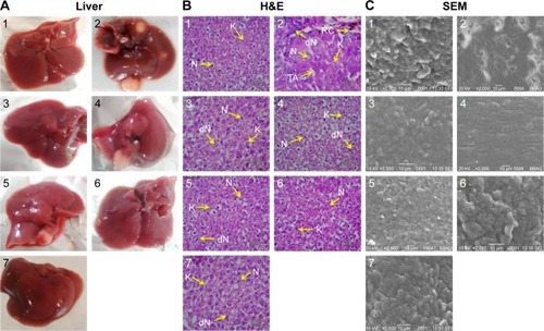Figure 7 The hepatic pathological changes in NDEA-induced rats.Notes: (A) Intact liver showing numerous carcinogenic nodules in the carcinogen control group that were reduced significantly or absent after treatments with 5-FU, B (50), B (100), BNP (50) and BNP (100). (B) Histopathological changes (40×, scale bar 50 µm). (C) SEM photomicrographs of the liver tissues (2,000×). Again, histopathology and SEM analysis show that BNP has greater potential to restore liver cell architecture than B. The studied groups are as follows: (1) NC, (2) CC (NDEA), (3) PC (NDEA + 5-FU), (4) NDEA + B (50), (5) NDEA + B (100), (6) NDEA + BNP (50) and (7) NDEA + BNP (100). N, normal nucleus; dN, degenerated nucleus; RC, ruptured hepatic cells; TA, tumor anaplastic cells and K, Kupffer cells.Abbreviations: NDEA, N-nitrosodiethylamine; 5-FU, 5-fluorouracil; B, betulinic acid; BNP, B nanoparticles; SEM, scanning electron microscopy; NC, normal control; CC, carcinogen control; PC, positive control; H&E, hematoxylin and eosin.