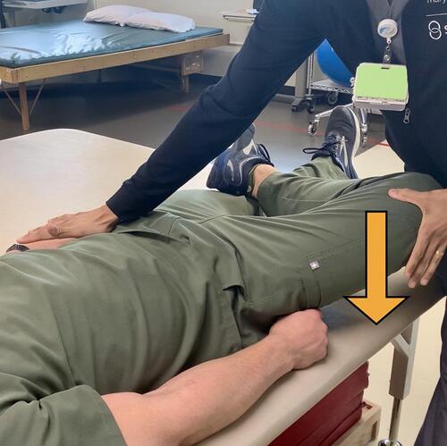 Figure 1 FABER Test (Patrick’s Test) – With the patient in a supine position, the lower extremity ipsilateral to the patient’s painful SIJ is correctly positioned by lying their lateral ankle on the contralateral anterior thigh. Then with the clinician standing on the side of the painful SIJ, one hand must stabilize the contralateral ASIS with firm pressure, while simultaneously applying a downward force through the ipsilateral flexed, externally rotated and abducted lower extremity, as depicted by the arrow.