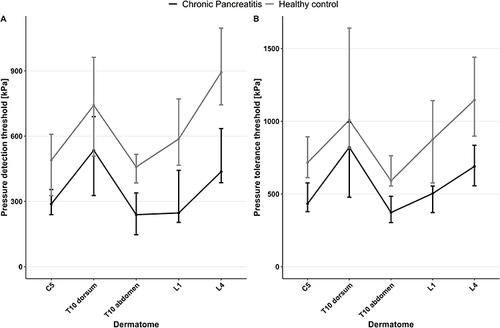 Figure 2 (A) Median pain detection thresholds in patients with chronic pancreatitis (n = 17) and healthy controls (n = 20), Whiskers mark interquartile range, (B) Median pain tolerance thresholds in patients with chronic pancreatitis (n = 17) and healthy controls (n = 20), Whiskers mark interquartile range.