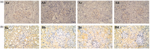 Figure 8. Representative Ki-67 immunohistochemistry of the kidney from rats exposed to different doses of tsothel (66.70, 33.35 and 16.68 mg/kg) after 180 days of administration and 30 days of drug withdrawal (N = 160). (A) Representative Ki-67 immunohistochemistry of the kidney after 180 days of administration. (B) Representative Ki-67 immunohistochemistry of the kidney after 30 days of drug withdrawal. Immunoperoxidase staining, ×200 magnification. a: Control group; b: 66.70 mg/kg tsothel group; c: 33.35 mg/kg tsothel group; d: 16.68 mg/kg tsothel group.