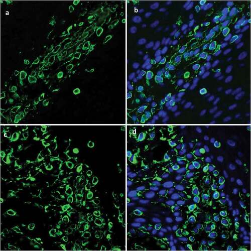 Figure 6. Immunofluorescence staining of CK15 expression in epithelial tissue shows CK15+cells (green) scattered within every layer of in vitro reconstructed tissue (A, B) and with distribution pattern similar that seen in normal oral mucosal epithelium (C, D).