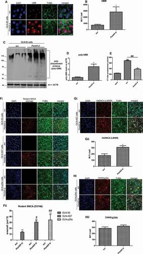 Figure 3. Downregulation of the Psmb5 (proteasome (prosome, macropain) subunit, beta type 5) gene increases both the endogenous rat oligodendroglial and overexpressed human SNCA protein levels, whereas overexpressed TPPP/p25A levels remain unaltered. (A-D) The levels of ubiquitinated proteins (UBB) are increased upon Psmb5 downregulation. (A) Representative immunofluorescence images of OLN-93 cells treated with siRNAs targeting the rat Psmb5 gene (Psmb5 si, 10 nM) for 72 h. Scrambled RNA sequences (scr) were used as negative control. The antibodies utilized were against TUBA (green) and UBB (red). DAPI was used as a nuclear marker. Scale bar: 5 μm. (B) Quantification of UBB protein levels in OLN-93 cells, measured as M.F.I./cell. Data are expressed as the mean ± SE of three independent experiments with duplicate samples/condition within each experiment; *p < 0.05, by Student’s unpaired t test. (C) Representative immunoblots of RIPA-soluble protein cell extracts probed for poly-ubiquitinated (poly-UBB) proteins and ACTB (as loading control) antibodies, demonstrating the accumulation of poly-UBB proteins following Psmb5 silencing. (D) Quantification of the poly-UBB protein levels in OLN-93 cells treated with scr or Psmb5 siRNAs for 72 h. Data are expressed as the mean ± SE of three independent experiments with duplicate samples/condition within each experiment; *p < 0.05, by Student’s unpaired t test. (E) Quantification of the CT-like proteasomal activity in OLN-93 cells treated with Psmb5 or scr siRNAs for 72 h. Data are expressed as the mean ± SE of three independent experiments with duplicate samples/condition within each experiment; *p < 0.05; ***p < 0.001, by one-way ANOVA with Tukey’s post hoc test (to compare between the epox-treated and the scr- or Psmb5 siRNAs-treated cells), ###p < 0.001, by one-way ANOVA with Tukey’s post hoc test (to compare between the scr- and Psmb5 siRNAs-treated cells). (Fi) Representative immunofluorescence images of OLN-93, OLN-AS7 and OLN-p25α cells treated with scr or Psmb5 siRNAs (10 nM) for 72 h. The antibodies utilized were against TUBA (green) and rat SNCA (red, D37A6 antibody). DAPI was used as a nuclear marker. Scale bar: 25 μm. (Fii) Quantification of the endogenous rat SNCA protein levels measured as μm2 area surface/cell following treatment of OLN cells with Psmb5 or scr siRNAs for 72 h. Data are expressed as the mean ± SE of three independent experiments with duplicate samples/condition within each experiment; p**<0.01; by one-way ANOVA with Tukey’s post hoc test (to compare between siRNA-treated and untreated cells) or #p < 0.05; ##p < 0.01 by two-way ANOVA with Bonferroni’s correction (to compare between the different cell lines). (Gi) Representative immunofluorescence images of OLN-AS7 cells showing the increased protein levels of human SNCA following siRNA delivery targeting Psmb5 using antibodies against human SNCA (red, LB509 antibody) and TUBA (green) and DAPI staining. Scale bar: 25 μm. (Gii) Quantification of human SNCA protein levels in scr- or Psmb5 siRNA (10 nM, for 72 h) transfected OLN-AS7 cells measured as M.F.I./cell. Data are expressed as the mean ± SE of three independent experiments with duplicate samples/condition within each experiment; *p < 0.05; by Student’s unpaired t test. (Hi) Representative immunofluorescence images of OLN-p25α cells showing the protein levels of human TPPP/p25A upon molecular inhibition of the proteasome using antibodies against human TPPP/p25A (red) and TUBA (green) and DAPI staining. Scale bar: 25 μm. (Hii) Quantification of human TPPP/p25A protein levels in scr- or Psmb5 siRNA (10 nM, for 72 h) transfected OLN-p25α cells measured as M.F.I./cell. Data are expressed as the mean ± SE of three independent experiments with duplicate samples/condition within each experiment.