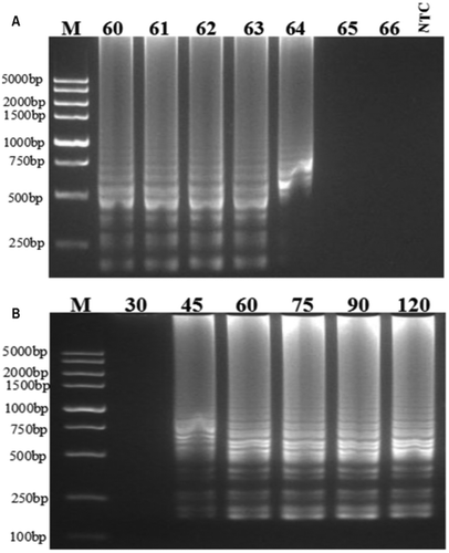 Fig. 1 Optimization of the reaction conditions used for RT-LAMP to detect PepMoV on an agarose gel. (a) Incubation temperatures: 60ºC, 61ºC, 62ºC, 63ºC, 64ºC, 65ºC and 66ºC. (b) Incubation duration: 30 min, 45 min, 60 min, 75 min, 90 min and 120 min. M indicates the 5 kb DNA ladder (Vazyme). NTC indicates the non-template control.