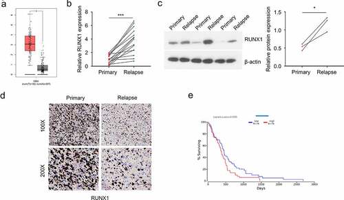 Figure 1. RUNX1 is highly expressed in GBM and associated with a poor prognosis (a) The expression of RUNX1 in GBM tumors and normal brain tissues was compared using data from GEPIA database. (b-d) Relative mRNA and protein level of RUNX1 in primary and recurrent GBM samples, analyzed by qRT-PCR (b), Western blot (c) and immunochemistry (d) E. Kaplan–Meier survival assessment of GBM patients, which were divided into low and high RUNX1 expression groups (n = 76 in each group, P < 0.05). Each sample was analyzed in 3 independent experiments. * P < 0.05 and *** P < 0.001