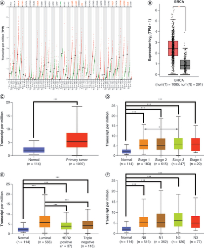 Figure 1. Expression of SIX4 is high in breast cancer, especially in luminal subtypes. (A) Expression pattern of SIX4 in different types of malignancies. Dots in the figure represent different samples: red for tumors and green for normal tissue. In different types of malignancies, the cancerous tissues with significantly increased SIX4 are labeled in red and include BRCA, CESC, ESCA, LUAD, LUSC, OV, TGCT, THYM, UCEC and UCS, while malignant tissues with decreased SIX4 are labeled in green and include LAML. (B & C) The increased SIX4 level in breast cancer compared with normal tissues in GEPIA and UALCAN. (D) Expression of SIX4 in different stages of breast cancer. (E) Expression of SIX4 in different molecular subtypes of breast cancer. (F) Expression of SIX4 in different lymph node statuses.BRCA: Breast invasive carcinoma; CESC: Cervical squamous cell carcinoma and endocervical adenocarcinoma; ESCA: Esophageal carcinoma; GEPIA: Gene Expression Profiling Interactive Analysis; LAML: Acute myeloid leukemia; LUAD: Lung adenocarcinoma; LUSC: Lung squamous cell carcinoma; OV: Ovarian serous cystadenocarcinoma; TGCT: Testicular germ cell tumor; THYM: Thymoma; UALCAN: University of Alabama at Birmingham Cancer portal; UCEC: Uterine corpus endometrial carcinoma; UCS: Uterine carcinosarcoma.