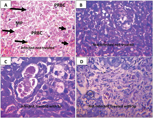 Figure 3. (a-d): Photomicrograph of cross histological section of the placenta from mice showing; A (infected not treated), B (not infected not treated) C (infected treated with fansidar) D (not infected treated with fansidar) (a) Trophoblastic cells that appear pyknotic (long arrow) in the infected mouse, degeneration and coagulative necrosis (small arrow) of the labyrinth, parasitized red blood cells and malaria parasite pigments). (b-d) No visible lesions in both infected (treated) and non-infected groups. H and E × 400
