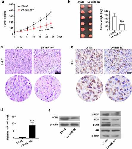 Figure 8. MiR-107 overexpression reduced the tumorigenic potential of FaDu HSCC in vivo. FaDu cells transfected with LV-based miR-107 or LV-NC were subcutaneously injected into the right armpit of the mice. (a) The tumor volume was measured every 3 days when the tumor was macroscopic. (b) At day 24, the tumor was collected and weighted. (c) The tumor tissues were stained with H&E. Scale bar = 100 μm. (d) The level of miR-107 was detected by RT-qPCR. (e) The expression of NOB1 was measured via IHC assay. Scale bar = 50 μm. (f) Evaluation of NOB1, p-PI3K, PI3K, p-Akt, and Akt protein expressions. Data were expressed as means ± SD (n = 6). &&&P < 0.001 versus the LV-NC group. LV, lentivirus.