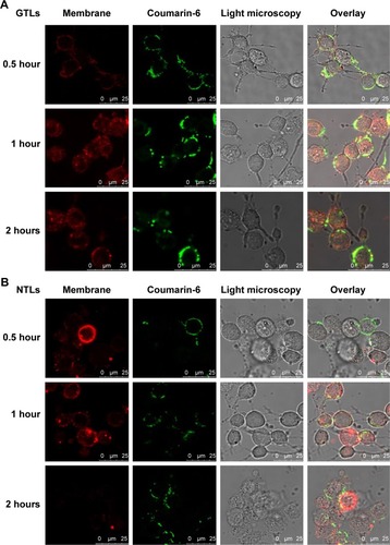 Figure 4 The localization of GTLs (A) and NTLs (B) as well as the interaction of the liposomes with cell membranes is shown.Notes: TN-C-positive C6 cells were incubated with coumarin-6 labeled GTLs and NTLs at 4°C for 0.5 h, 1 h, and 2 h, respectively. The corresponding confocal microscopy images were taken, green represents the fluorescence of coumarin-6 and red represents the fluorescence of DiI.Abbreviations: NTLs, nontargeted gadolinium-loaded liposomes; GTLs, GBI-10-targeted gadolinium-loaded liposomes; DiI, 1,1′-dioctadecyl-3,3,3′,3′-tetramethylindo carbocyanine perchlorate.