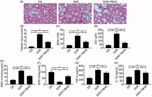 Figure 4. TBHQ pretreatment alleviates acute kidney injury, oxidative stress, and inflammatory responses after I/R in diabetic rats. (A) Representative images of H&E staining of renal tissues (magnification, ×400), arrows indicate tubular necrosis. (B) Histopathological scoring. (C) BUN concentration. (D) SCr concentration. (E) MDA content in kidney tissues. (F) SOD activity in kidney tissues. (G) TNF-α level in kidney tissues. (H) IL-1β level in kidney tissues. The results are presented as mean ± SD. *p < .05.