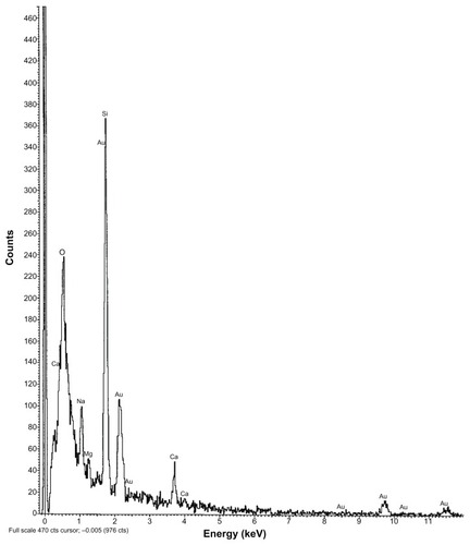 Figure 4 EDX data showing the presence of gold particles in gold-encapsulated polymeric nanoparticles.Abbreviation: EDX, energy dispersive X-ray spectroscopy.