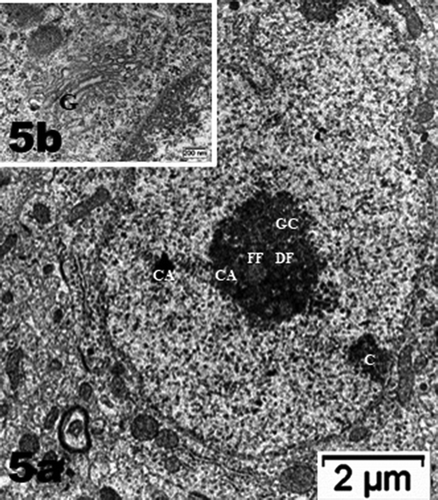 Figure 5. (a–d): Selected views of NN murine neuron cell bodies of the latero-ventral thalamic nuclei and enlarged aspects of nucleoli. (a, c and d): Euchromatic nuclei with slightly indented envelopes with quasi centrally-located nucleoli with their 3 main highly active transcriptional featured components: CA: chromatin associated, part of (c): chromatin, as associated with the inner nuclear envelope; DF: dense fibrillar, FF: fine fibrillar region accompanied by its cloud of ribonucleoprotein transcript products as granules i.e. small and large ribosomal and other RNAs (Granular Component as GC). (b) Enlarged Golgi zone of (a)