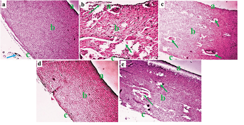 Figure 6. Composite photomicrographs of the aorta of non-diabetic and diabetic pigs showing normal tunica intima (a), tunica media (b), tunica adventitia (c), and Vasa vasorum characteristics (a); marked tunica intima ulceration, medial cystic necrosis, and some fibrinoid necrosis (arrow) in the aortic medium (b&e); and revealed normal tunica intima (a), tunica media (b), and minor disruption of the tunica adventitia (c) (c&d). H&E X 250. A = aorta of normal control pigs, B = aorta of atherosclerotic control pigs, C = aorta of pigs treated with 250 mL/day Camel milk, D = aorta of pigs treated with 500 mL/day Camel milk, E = aorta of pigs treated with Metformin.
