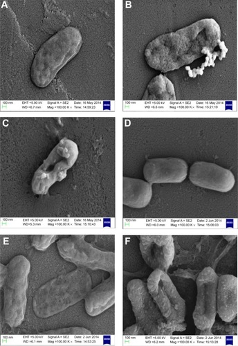 Figure 2 Scanning electron micrograph.Notes: (A) and (D) show control cells (without SNPs). (B) and (E) show CSNPs-treated cells. (C) and (F) PBSNPs-treated cells. (A–C) Vibrio fluvialis L-15318 and (D–F) Pseudomonas aeruginosa PAO1.Abbreviations: SNPs, silver nanoparticles; CSNPs, citrate-capped silver nanoparticles; PBSNPs, polymyxin B-capped silver nanoparticles.