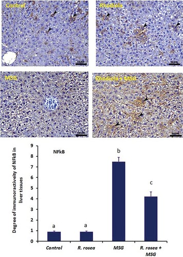 Figure 7. Liver sections of control (Upper left photo) and R. rosea (Upper right photo) groups show very faint immunoreactivity for NFkB within hepatocytes (arrowheads). Down left photo is the liver section of the MSG group, showing high expression of NFkB within hepatocytes of the liver (in centrilobular area; arrowheads). Down right photo is the liver section of the MSG plus R. rosea-treated group, showing a decrease in NFkB immunoreaction (arrowheads) in almost all hepatocytes. Scale bar for all fields is 50 µm. The area percentage (%) of NFkB immunoreactivity in 6 separate fields/sections is shown in E. All values are expressed as means + SE and the significance level is reported at p < 0.05. Values with different letters are significant at *p < 0.05 compared to other groups.