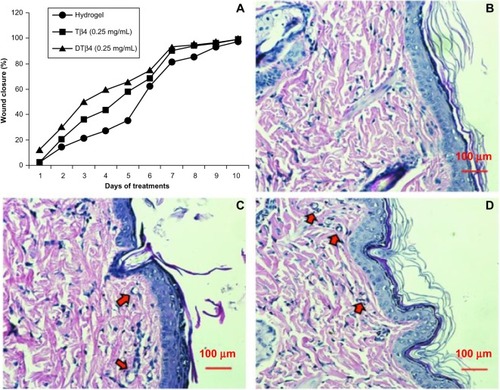 Figure 8 Wound repair evaluation proved either dimeric thymosin beta 4 (DTβ4) or thymosin beta 4 (Tβ4) increased the healing of punch wounds in rats at 0.25 mg/mL. (A) The rates of 50% healing in mid-dose DTβ4-treated (0.25 mg/mL) rats were approximately 3 days faster than the plain hydrogel or 1 day faster than Tβ4-treated rats. The healing of the plain hydrogel and Tβ4-treated rats eventually caught up with the mid-dose DTβ4 treatment at days nine and seven, respectively. Histological sections of (B) plain hydrogel, (C) DTβ4, and (D) Tβ4 show good re-epithelialization and angiogenesis in subcutaneous tissues. Compared with plain hydrogel, DTβ4 and Tβ4 resulted in more capillary growth (arrows).