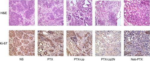 Figure 8 Representative tissue photomicrographs (H&E and antigen Ki-67 stain) from control group and treatment groups by PTX, PTX-Lip, PTX-Lip2N and nab-PTX. Magnification, 400×.