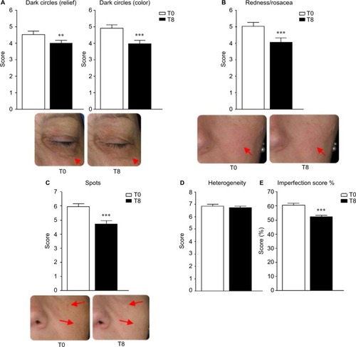 Figure 2 Evaluation of the facial skin imperfections before and after supplementation.