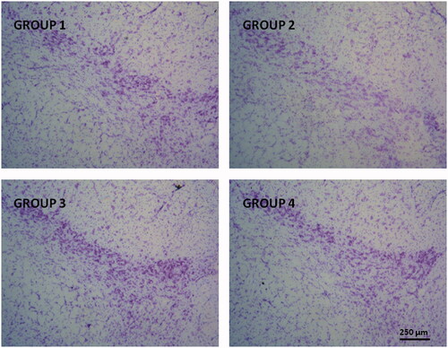 Figure 4. Representative Nissl-staining (cresyl violet) of nigral neurons from brain sections (substantia nigra pars compacta, 30 µm) corresponding to all animal groups. G1: control group; G2: RT-treated control group; G3 and G4 RT-treated animals also receiving; G3: RP-loaded PLGA nanoparticles and G4: RP in saline; RT: rotenone; RP: ropinirole.