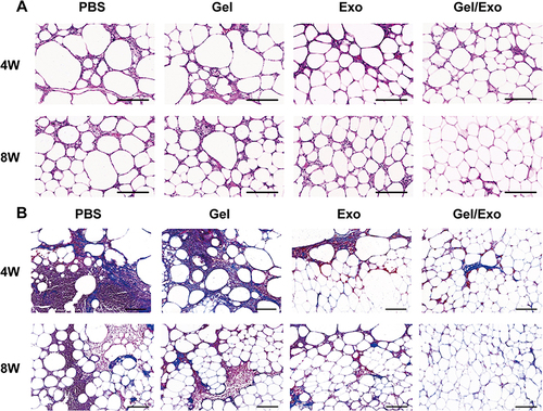 Figure 6 Histological evaluation of the harvested fat. (A) Representative HE-stained images of fat grafts in the different treatment groups at 4 and 8 weeks after autologous fat grafting. Scale bars: 200 μm. (B) Representative Masson’s trichrome-stained images of graft fat in different treatment groups 4 and 8 weeks after autologous fat grafting. Scale bars: 200 μm.
