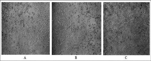 Figure 4. Morphology of HeLa cells after 72 h of incubation with allicin (A) and its transformation products (B) at a concentration of 3 mg/mL, as well as control culture (C); phase contrast, magnification 100×.