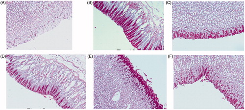 Figure 4. Light micrographs showing the effect of compounds 3, 8, 11 and 15 on ethanol-induced gastric lesions of rats. (A) Treatment with ethanol (PAS); (B) pre-treatment with standard drug ranitidine (50 mg/kg) (PAS); (C) pre-treatment with compound 3 (50 mg/kg) (PAS); (D) pre-treatment with compound 8 (50 mg/kg) (PAS); (E) pre-treatment with compound 11 (50 mg/kg) (PAS); (F) pre-treatment with compound 15 (50 mg/kg) (PAS).