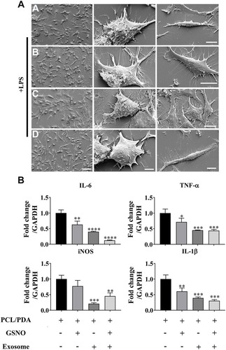 Figure 6 Scaffold-induced changes in macrophage morphology captured by scanning electron microscopy (SEM) after LPS stimulation. (A) Representative SEM images of RAW264.7 cells co-cultured with PCL/PDA (a), PCL/PDA + GSNO (b), PCL/PDA + exosome (c), and PCL/PDA + GSNO + exosome (d) scaffolds. RAW 264.7 cells were stimulated with 1 μg/mL LPS for 12 h before co-culturing with scaffolds for 24 h. Scale bars: 2 μm (left panel), 1 μm (middle and right panel). (B) Relative expression of inflammatory genes in RAW 264.7 cells after 12h stimulation with LPS and co-culture with scaffolds for a further 24 h. Values were normalized to the housekeeping gene, GAPDH. Error bars denote mean ± SD. *p < 0.05, **p < 0.01, ***p < 0.0005, ****p < 0.0001 relative to PCL/PDA control.