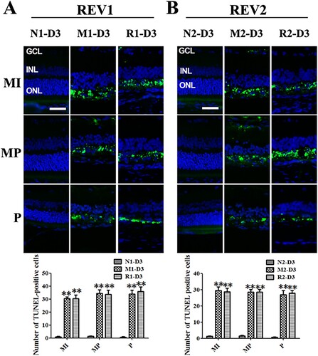 Figure 4. RSV-induced effect on cellular apoptosis in MNU-damaged retinas. A: Representative images of TUNEL assay and plot of quantification of TUNEL-positive cells in retinal sections from rats treated with RSV intervention of the first mode. B: Representative images of TUNEL assay and plot of quantification of TUNEL-positive cells in retinal sections from rats treated with RSV intervention of the second mode. (MI: the middle area of the retina; MP: the mid-peripheral area of the retina; P: the peripheral area of the retina; ONL: outer nuclear layer; INL: inner nuclear layer; GCL: ganglion cell layer; Scale bar: 50 µm; **P < 0.01 vs. vehicle group).