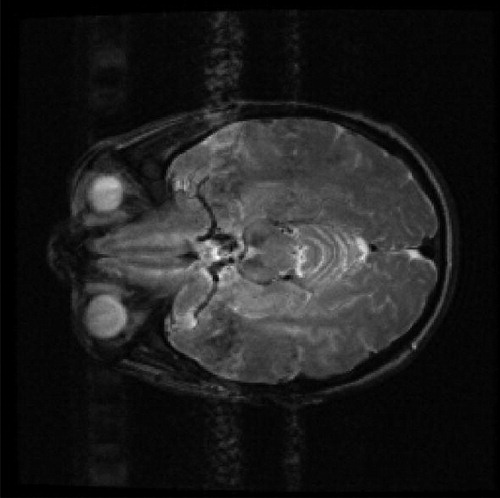 Fig. 7 One slice of real human brain with resolution 256 × 256.