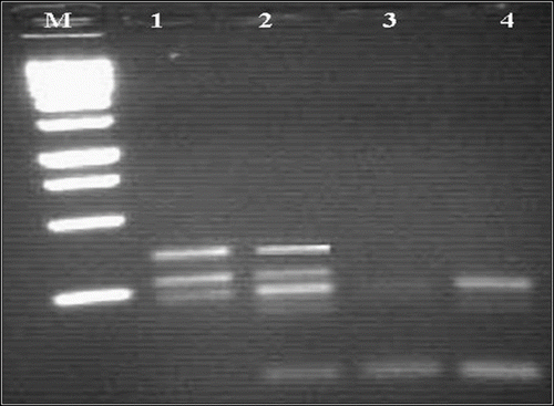 Fig. 4 Profil RAPD de quatre concentrations de l’amorce sur gel d’agarose 1,5%: résultats obtenus avec l’amorce OPJ14 (5’- CACCCGGATG -3’) chez S. lagascae. M: marquer de taille (1Kb); 1: 10 pM; 2: 20 pM; 3: 30 pM et 4: 40 pM. Fig. 4. RAPD profile obtained from different concentrations of primer OPJ 14 (5’- CACCCGGATG -3’) for S. lagascae. M: 1 Kb marker, 1: 10 pM; 2: 20 pM; 3: 30 pM and 4: 40 pM.