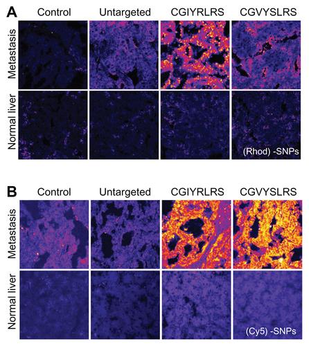 Figure S2 Single-color targeted SPNs recognize human hepatic metastases ex vivo Frozen sections (10-μm) of matched (grossly) normal liver and hepatic metastasis were fixed in 4% formaldehyde before being incubated with 5 × 1012 of either untargeted, CGIYRLRS-, or (A) CGVYSLRS-(Rhod)- or (B) (Cy5)-SPNs for 4 h at RT. After 3 washes in TBS-T, the SPN-emitted fluorescence was analyzed by confocal microscopy, and the output was converted in a false color LUT Fire scale for prompt visualization. The experiment was performed on specimens from 10 patients with metastatic CRC; exemplary images from tissues of patient #P85 are shown.Abbreviations: CRC, colorectal cancer; RT, room temperature; SPN, silica-poly(ethylene glycol) nanoparticles; TBS-T, Tris-buffered saline containing Tween-20.