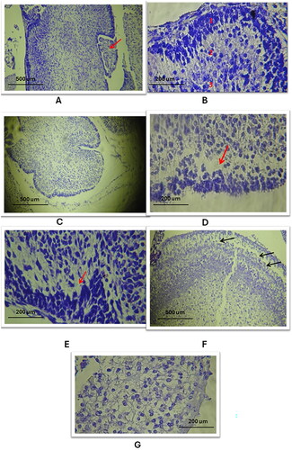 Figure 7. Histological changes of the outer and inner layers of the cerebellar cortex in the three study groups as compared to the control group (using Cresyl Violet stain). A. A/B: Control group: Normal cerebellar cortex, trilaminar structure visible with choroid plexus in 4th ventricle, layers: 1. Molecular, 2. Purkinje cells, 3. Granular (10X, 40X). C: Study group A: Cerebellar cortex atrophy, reduced size, expanded subarachnoid space (10X). D/E: Study group a and B: Loss of Purkinje cells layer, nuclear and parenchymal changes (red arrow) (40X). F/G: Study group C: Pronounced Purkinje cells absence, cortex parenchymal defects, significant nuclear and parenchymal alterations (black arrows) (10X, 40X).