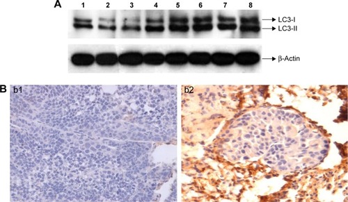 Figure 4 SIL upregulated the expression of autophagy-related protein LC3 in the experimental lung metastasis of ACC in nude mice.