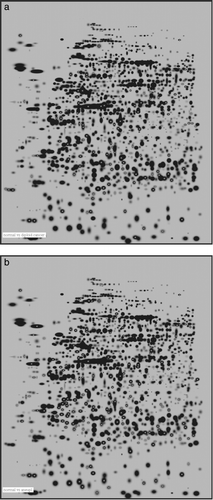 Figure 2.  a. 2-DE master image. Black spots are protein spots. The white markings (x) are the 192 spots differentiating normal from diploid samples by Mann-Whitney test with 99% significance level. b. 2-DE master image showing 238 spots (white x) differentiating normal from aneuploid samples by Mann-Whitney test with 99% significance level.