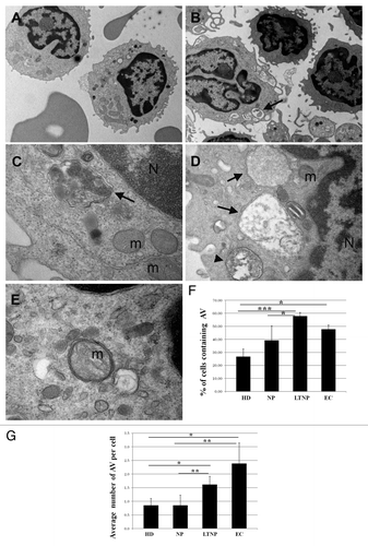 Figure 1. Ultrastructural analysis of PBMC from HIV-infected patients. (A) PBMC from NP, (B–E) from LTNP. Cells from HIV-1 controllers showed numerous AV containing undigested material, surrounded by a double membrane (arrows) or limited by a single membrane (arrowhead). N, nucleus; m, mitochondria. (F) Quantitative analysis of the percentage of cells containing AV in HD, NP, LTNP, and EC. (G) Quantitative analysis of the average number of AV per cell in HD, NP, LTNP, and EC. Original magnification: (A and B) 7.000×, (C and E) 50.000×, (D) 30.000×. *P < 0.05, **P < 0.01, ***P < 0.001.