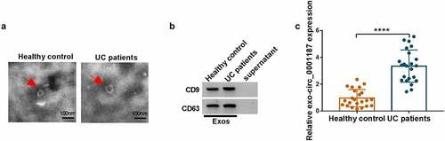 Figure 8. Exosomes mediated the transmission of circ_0001187. (a) The ultrastructure of exosomes derived from the serum of healthy normal controls and UC patients was observed under TEM. (b) The protein expression of CD9 and CD63 was detected by WB analysis. (c) The circ_0001187 expression in serum exosome from UC patients and healthy normal controls was determined by qRT-PCR. **P < 0.01, ****P < 0.0001.