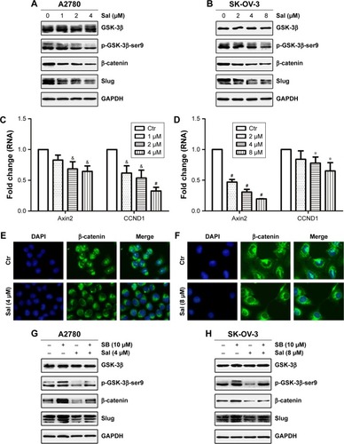 Figure 4 Salinomycin blocked the Wnt/β-catenin pathway in EOC cells.