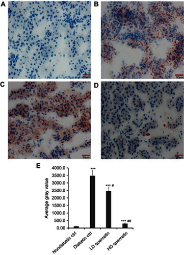 Figure 7 Effect of quercetin on the lipid accumulation in renal sections after administration for 10 weeks. Representative photomicrographs of Oil-Red-O staining (bar =50 μm in the field) in frozen kidney sections from db/m mice (A), db/db control mice (B), LD-quercetin treated db/db mice (C), and HD-quercetin treated db/db mice (D); (E) average gray value in different groups. The data obtained from three independent experimental studies are presented as the mean ± SD. ***P<0.001, compared with both non-diabetic groups; #P<0.05 or ##P<0.01, compared with diabetic control group.