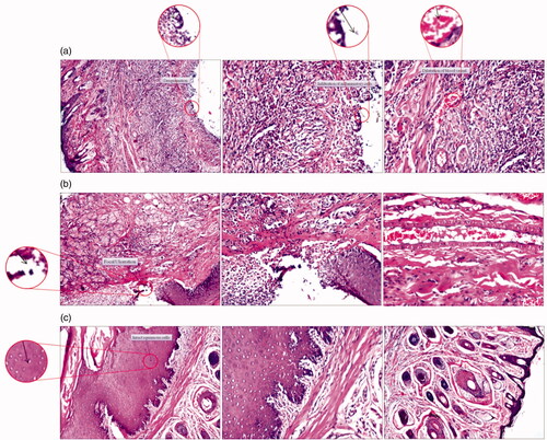 Figure 6. Representative photomicrographs (100x) of sections in the lips stained with H & E of (a) the control group of rats, (b) the group of rats receiving plain chitosan sponge and (c) the group of rats receiving medicated chitosan sponge.