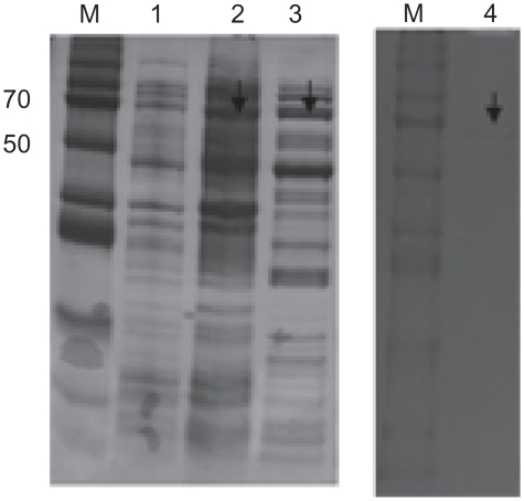 Figure 4 Purification of HCV-NS5B viral protein. The SDS-PAGE 10% gel showing NS5B protein with his-tag. M, protein marker; lane 1, before induction form of NS5B; lane 2, total form of NS5B; lane 3, soluble form of NS5B; lane 4, his-Tag form of NS5B.Abbreviations: HCV, hepatitis C virus; NS5B, non-structural protein 5B; SDS-PAGE, sodium dodecyl sulfate polyacrylamide gel electrophoresis.