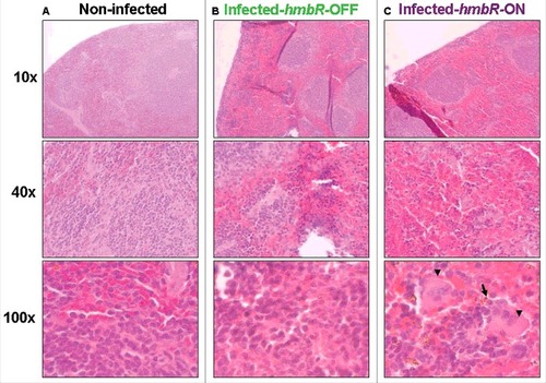 Figure 4. Spleen histopathology at different magnifications in transgenic mice either: (A) non-infected (negative control), (B) infected by the wild-type capsulated carriage isolate (CarB-3141-OFF) unable to express HmbR or (C) infected by the phase variant capsulated carriage isolate (CarB-3141-ON) able to express HmbR. Bacteria (arrow) and macrophages (arrow heads) are visible only for this later isolate. Presented data are typical representative pictures of three repeats for each of the two isogenic isolates (CarB-3141-OFF and CarB-3141-ON).