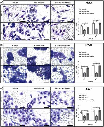 Figure 9. Adherence assays of UPEC-46 and derivatives with different epithelial cell lineages. The adherence ability was identified after 3 h and 6 h of infection, in the presence of 1% D-mannose, using (a) HeLa (human cervical adenocarcinoma), (b) HT-29 (human colon adenocarcinoma), and (c) 5637 (human urinary bladder carcinoma) cells. In qualitative adherence assays, the evaluation of the AA pattern was performed using light microscopy. Bars = 50 µm. For quantitative adherence assays, the number of cell-adhering bacteria was quantified 3 h and 6 h post-infection as described in materials and methods. The adherence assays with UPEC-46, UPEC-46::afpA, and UPEC-46::afpA (pPAS3) were performed in duplicate and repeated three times. The data presented represent of the mean ± standard deviation. The one-way analysis of variance (ANOVA) followed by Tukey’s multiple-comparison test was used for the statistical analysis. P-value: ** P < 0.01; *** P < 0.001; **** P < 0.0001