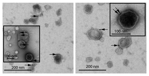 Figure 1 EM image showing presence of Hsp70 on exosome membrane. RAW 264.7 mouse macrophages were given heat-shock at 43°C for 2 h. After 6 h recovery at 37°C, exosomes were purified from culture supernatants by differential centrifugation and floatation on a sucrose gradient. The samples were processed for surface immunogold labeling with anti-Hsp70 antibody. Arrows show Hsp70 (gold) labeling on exosome surface. Insets show magnified images of exosomes with surface Hsp70 labeling. (Micrograph provided by Christopher K.E. Bleck).