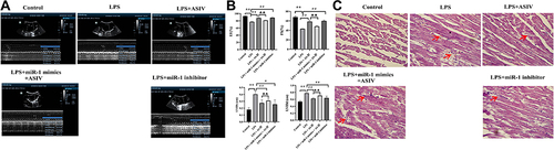 Figure 3 AS-IV improves heart dysfunction and attenuates the pathological changes of heart tissue in LPS-treated rats.