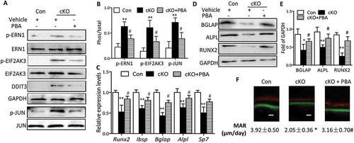 Figure 7. Administration of PBA partially reversed the suppression of bone formation by Atg7 deletion in vivo. PBA (5 mg/Kg) or vehicle was daily intraperitoneal injected to 3-wk-old cKO or control mice for 4 wks. By the end of 4-wk treatment period, total protein and RNA was extracted from calvaria (n = 3/group). (a and b) Expression of the ER stress markers (p-ERN1, p-JUN, DDIT3 and p-EIF2AK3). (c) Relative expression of Runx2, Ibsp, Bglap, Alpl, and Sp7 mRNA normalized to controls. (d and e) Expression of bone formation markers (BGLAP, ALPL and RUNX2). (f) Representative images of the double label staining in femur section with calcein and xylenol orange. Scale bars: 10 µm (mean ± SD, one-way ANOVA, *P < 0.05, **P < 0.01 cKO vs. Con, # P < 0.05 cKO + PBA vs. cKO).