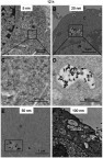 Figure 5 AgNPs uptake by B16 cells after 12 hours incubation. (A, B, E, F) The representative TEM images of 5 nm, 20 nm, 50 nm, and 100 nm AgNPs. (C, D) The amplified images of A and B, respectively.Abbreviations: AgNPs, silver nanoparticles; TEM, transmission electron microscopy; N, nucleus; C, cytoplasm.