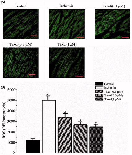 Figure 2. Taxol reduces the levels of reactive oxygen species (ROS) during ischemia. (A) Representative qualitative assessment of ROS (×400 magnification). Bar, 40 μm. (B) ROS level. Values are the mean ± SE (n = 15 per group). *p < 0.05 versus the control group; Δp < 0.05 versus the control group and the ischemia group; ∇p < 0.05 versus the control group, the ischemia group, and taxol (0.1 and 0.3 μM) groups.