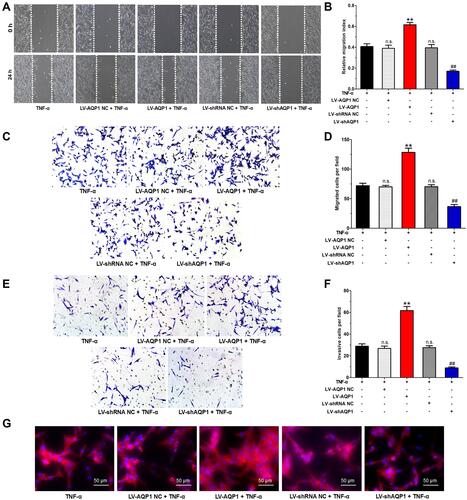 Figure 4 Effects of AQP1 overexpression or silencing on migration and invasion of TNF-α-stimulated MH7A cells. (A) Typical photos indicated the initial (0 h) and final (24 h) positions of cells after scraping from various groups (wound-healing assay, ×100). (B) Histogram of the relative migration indexes. (C) Typical photos of MH7A cells crossing through the membrane coated without matrigel from various groups (transwell assay, ×100). (D) Histogram of the migrated cell numbers per microscopic field. (E) Typical photos of MH7A cells crossing through the membrane coated with matrigel from various groups (transwell assay, ×100). (F) Histogram of the invasive cell numbers per microscopic field. (G) Typical photos of fluorescent phalloidin staining from various groups (×100). Fluorescent phalloidin was used to stain cells to make F-actin (red) visible and DAPI was used to stain the cell nuclei (blue). The data are mean ± SEM of three independent experiments performed in triplicate. n.s. compared with non-transfected control group. **P < 0.01 compared with LV-AQP1 NC group. ##P < 0.01 compared with LV-shRNA NC group.